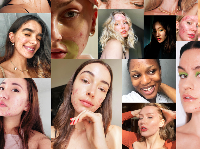7 Skincare Influencers For Beauty Campaigns